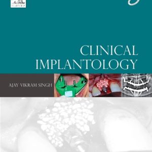 CLINICAL IMPLANTOLOGY, 1E